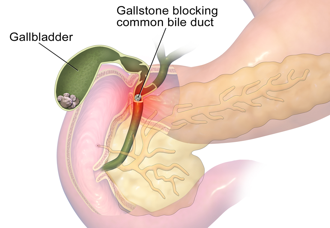 Laparoscopic Surgery in Jaipur